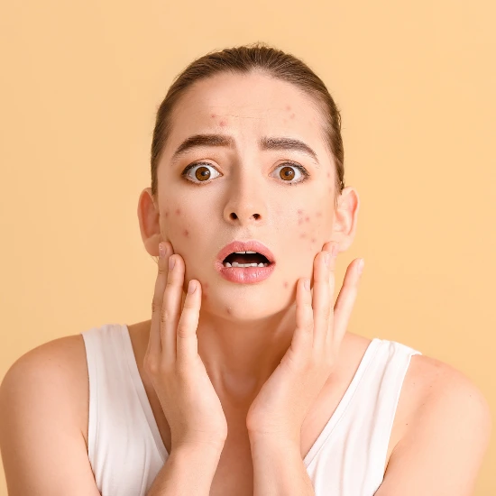 PCOS and Periods Problem