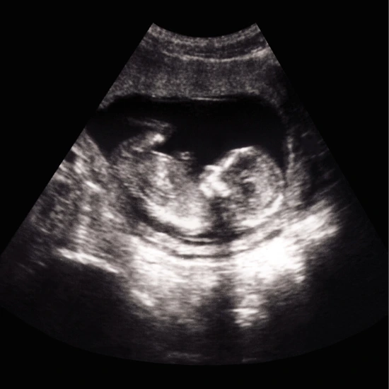 Pregnancy care